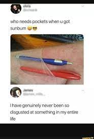 Who Needs Pockets When U Got Sunburn W C I Have Genuinely Never Been So Disgusted At Something In My Entire Life Ifunny Sunburn Meme Sunburn Funny Laugh