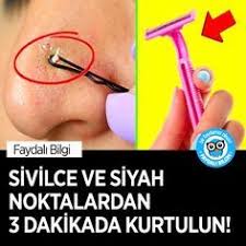 Sivilce Ve Siyah Noktalardan Kurtulun Siyah Noktalar Cilt Bakimi Cilt Bakimi Tuyolari