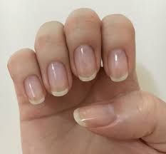 ネイルベットを伸ばす 深爪矯正を自力でした結果 8ヶ月で綺麗な爪に ブログでbefore after大公開 かんとら 綺麗な爪 深爪 ネイル