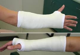 The wrist may be tender, slightly swollen, and painful to move. Forearm Fractures In Children Types And Treatments Orthoinfo Aaos