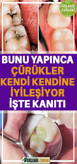 Curukler Gercekten Kendi Kendine Iyilesir Mi Iste Kaniti Skin Health Health Drink Diet