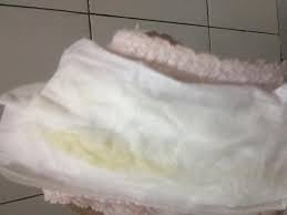 Penyakit kuning saat hamil muda. Flek Kuning Saat Hamil 9 Week Ibuhamil Com