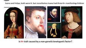 The habsburg jaw, which is also known as the habsburg lip, is one of the most common genetic disorders found in royal families. A Real Game Of Thrones The Habsburg Jaw Youtube