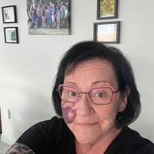 Has anyone experienced heart rate changes after stopping sotalol?