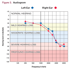 The Psychiatric Assessment Of People Who Are Deaf Or Hard Of