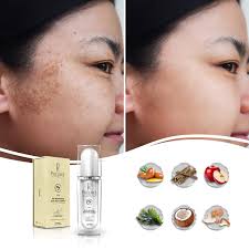 This Bio Brightening Dark Spot Solution lighten freckles, age spots or dark  pigmentation areas. It promotes cell regeneration, maintains collagen, and  retains hydration. For younger looking skin, free of age spots and