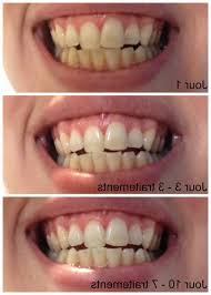 Blanchiment Dents Maroc Et Blanchir Dent Maison Curcuma Specialiste Depuis 1999