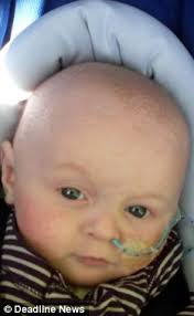 Mother thrown out of Costa coffee as noise of her tube-fed disabled baby  upset customer