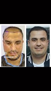 Nutrition and exercise are absolutely...