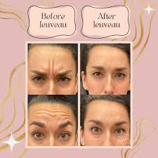 White Lake Medical Clinic Avera