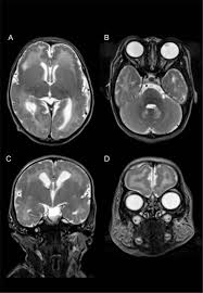 Image result for Mohria marginalis