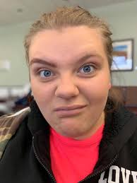 You looked beautiful before the surgery ❤