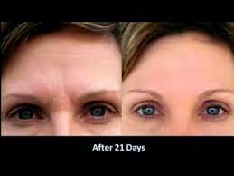 (click here to get yours) algenist firming & lifting serum cream the name says it all. How To Get Rid Of 11 Lines Between Eyebrows Eyebrowshaper