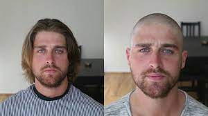 Pin By Robert Vallerini On Shaved Head Hair System Hair Replacement Systems Hair And Beard Styles