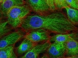 1 way for your doctor to determine how fast your. Spotting Breast Cancer S Spread To The Brain Before Symptoms Start Could Improve Survival