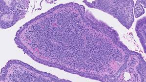 Image result for Centrostigma papillosum