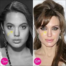 Angelina jolie was born in los angeles on 4 june 1975. Angelina Jolie Plastische Chirurgie Zwickt Um Ihre Schonheit Zu Verbessern Ang Angelina Jolie Nose Job Rhinoplasty Nose Jobs Angelina Jolie Plastic Surgery
