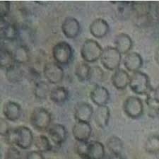 Image result for Dissotis brazzae