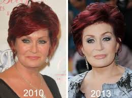 Sharon Osbourne Plastic Surgery Before After Sharon Osbourne Plastic Surgery Plastic Surgery Before After