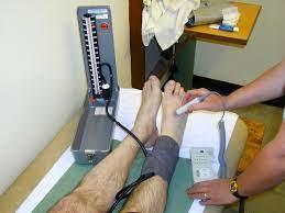 How do standard readings in the legs compare with those obtained in the arms? Claudication Cramp When Walking Vascular Society