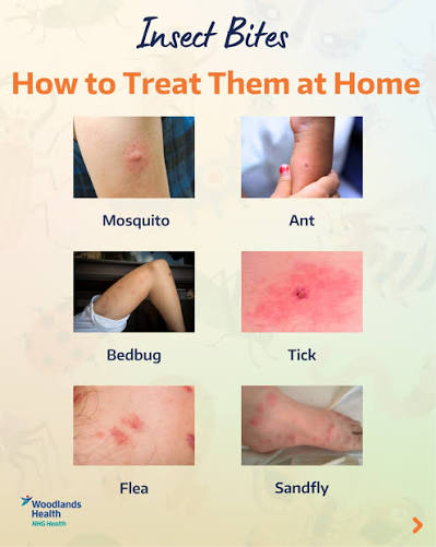 𝗪𝗛𝗧𝗶𝗽𝘀 Bitten by a bug? 🦟🕷️🪲 Most insect bites from mosquitoes,  ants, bedbugs, ticks, fleas or sandflies can be safely treated at home. The  key is to ease the itch, avoid infection