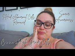 ABNORMAL CELL TREATMENT, LLETZ PROCEDURE, CIIN 3 HIGH GRADE CELLS, HOW I'M  FEELING