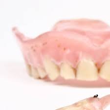 Ihr nutzen eine cover denture prothese ist an den natürlichen restzähnen befestigt und ist dadurch in ihrer lage stabil gesichert. Neue Cover Denture Prothese Mit 12 Ersetzten Zahnen Abrechnung