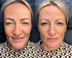 PERMANENT POWDER BROWS • • With permanent make up we can achieve very soft  and natural results. • Eyebrow shape and colour will be selected according  to your skin type and