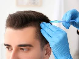 افضل طرق علاج تساقط الشعر للرجال وتكثيفه معلومة