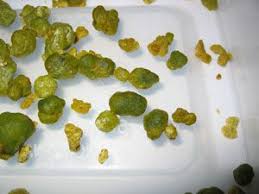 Do You Know You Probably Have Many Liver Stones And Gallbladder Stones Stuck In Your Liver And Gallbladder Most People Liver Flush Healthy Happy Home Remedies