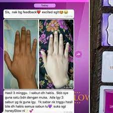 Check spelling or type a new query. Keburukan Sabun Honey Glow Malayrexa