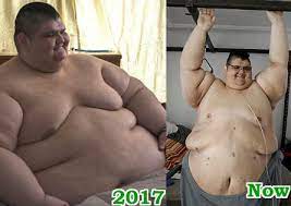 Juan pedro franco, de 32 años, llegó a pesar cerca de 590 kilos en 2017, pero al dejar su salud en manos de un grupo de médicos en guadalajara ha perdido. World News Naijagists Com Proudly Nigerian Diy Motivation Information Blog Part 10