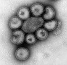 Image result for Influenza