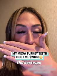Fake Teeth in Turkey