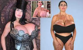 Woman who had 5200cc breast implants is refused but | Daily Mail Online