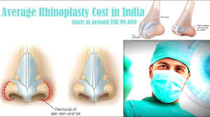The cost of a rhinoplasty surgery in india varies between 50k to 1 lakh.the cost of nose surgery (rhinoplasty) in india is around $1600.the cost of nose surgery in india is a fraction of what it costs in the developed nations. Rhinoplasty Cost In India Average Rhinoplasty Cost In India Youtube