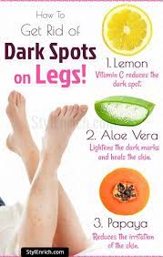 Blemishes do not deny access to any part of the body. How To Get Rid Of Dark Spots On Legs Beautytipsbody Dark Spots On Skin Dark Spots On Legs Spots On Legs