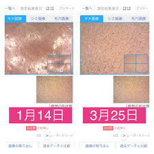 肌 キメ が ない