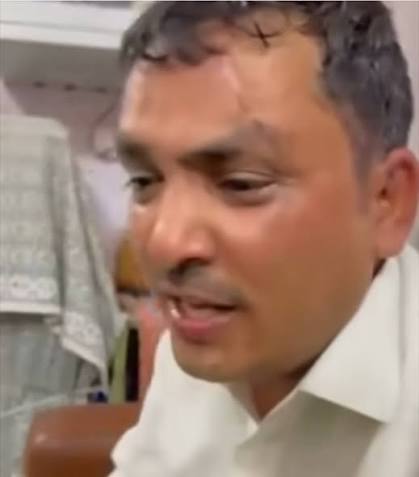 शिक्षक ने फेंका डस्टर, छात्रा का सिर फूटा; घटना छिपाने का भी आरोप गढा पीएमश्री स्कूल की घटना,शिक्षक को नोटिस जारी