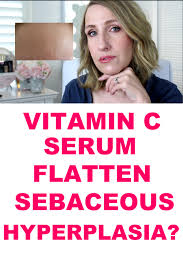I usually consider acne scarring, melasma, sebaceous hyperplasia, deep set in rhytids (wrinkles) in this category. Sebaceous Hyperplasia Treatment Anne P Makeup And More