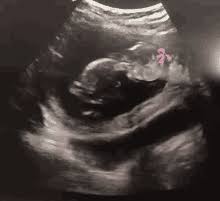 Funny Ultrasound Gifs Tenor