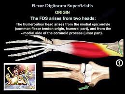 The forelimb superﬁcial digital ﬂexor tendon (sdft) is far more likely to be injured than Flexor Digitorum Superficialis Everything You Need To Know Dr Nabil Ebraheim Youtube