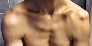 Image result for shoulder dislocation