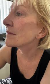 Dr Angela Xu will now be available for 1 Sunday ONLY! 🥳 ✨CSD Clinics OPEN  Sunday 13th March 👉CSD Clinics will be CLOSED MONDAY 14th March, 2022 Book  in for your treatment