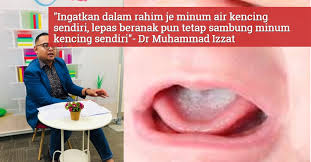 Berikut beberapa penyebab sering kencing / buang air kecil serta gejala lainnya yang mungkin kandung kemih yang terlalu over aktif merupakan penyebab kedua dari sering nya rasa ingin buang hal ini dikarenakan tubuh sedang berusaha untuk membersihkan glukosa yang tidak terpakai di. Menghilangkan Kesan Methamphetamine Dari Air Kencing