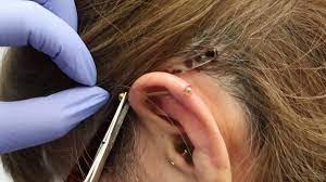 Infected Piercing That S How You Take Care Of It