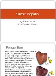 Maybe you would like to learn more about one of these? Sirosis Hepatis Pdf