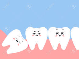 The least they could do is help each other out! Incorrectly Positioned Wisdom Tooth Cartoon Displeased Teeth Vector Illustration Lizenzfrei Nutzbare Vektorgrafiken Clip Arts Illustrationen Image 143521647