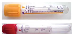 Pathology And Microbiology Tests Directory Epsom And St