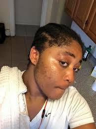 How to Use Baking Soda to Remove Spots, Wrinkles and Dark Circles from the  Face😍 Ingredients: 2 Tablespoons of Baking Soda 1 Tablespoon of Extra  Virgin Coconut Oil 1 Teaspoon of Honey